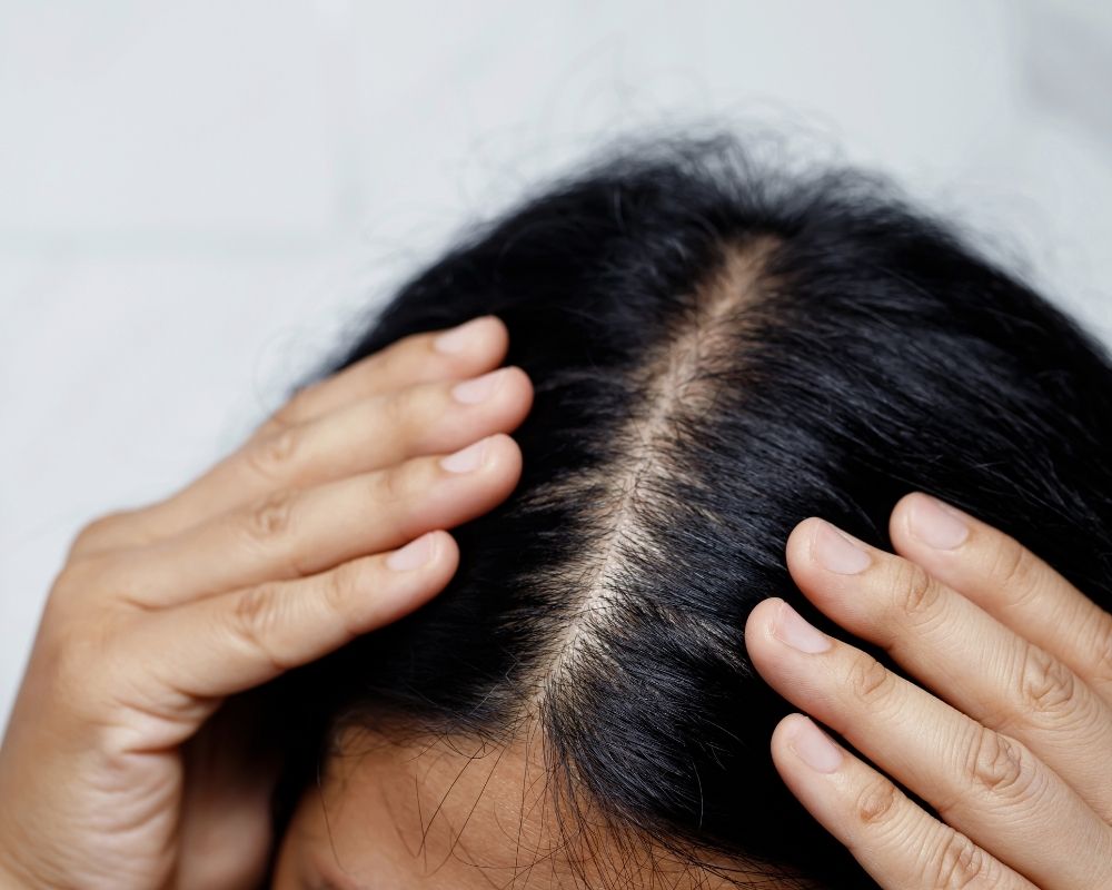 頭皮が臭うのはなぜ？専門家が教える5つの原因と根本から解決するニオイ対策